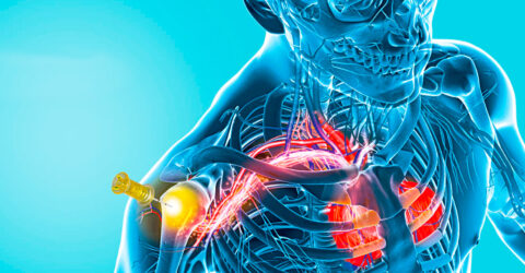 acesso-intraosseo-full-emergency