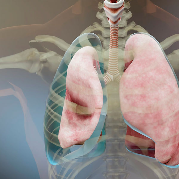 pneumotorax-aberto-curativo-tres-pontas-full-emergency
